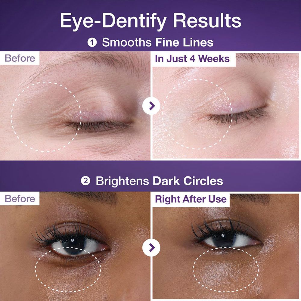 کرم دور چشم نامبوزین شماره 9 با ترکیب رتینول و NAD+